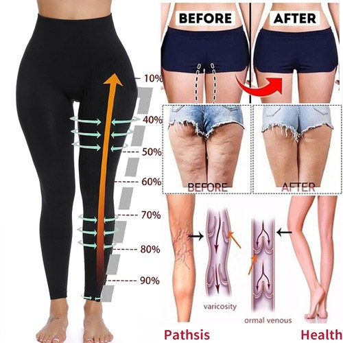 Anti cellulite women - cellulite,